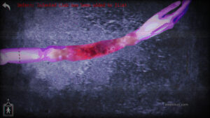 An injured arm in Smile More